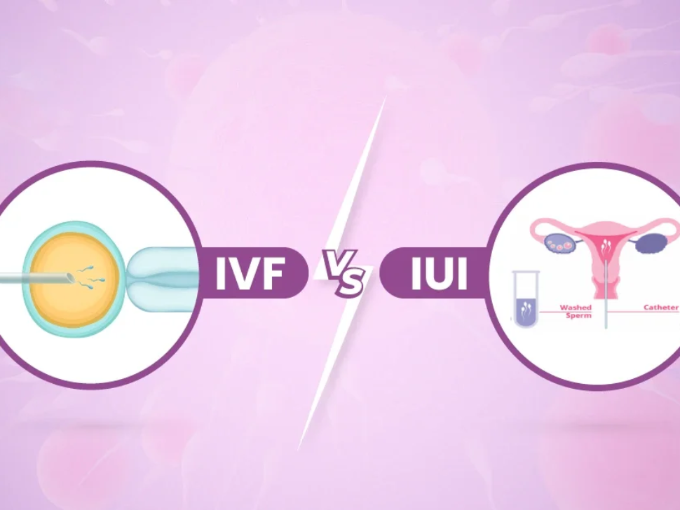 The Difference Between IUI and IVF: A Comprehensive Guide