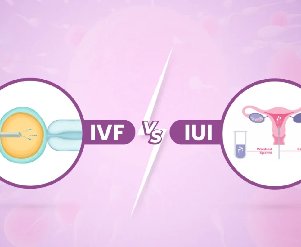 The Difference Between IUI and IVF: A Comprehensive Guide