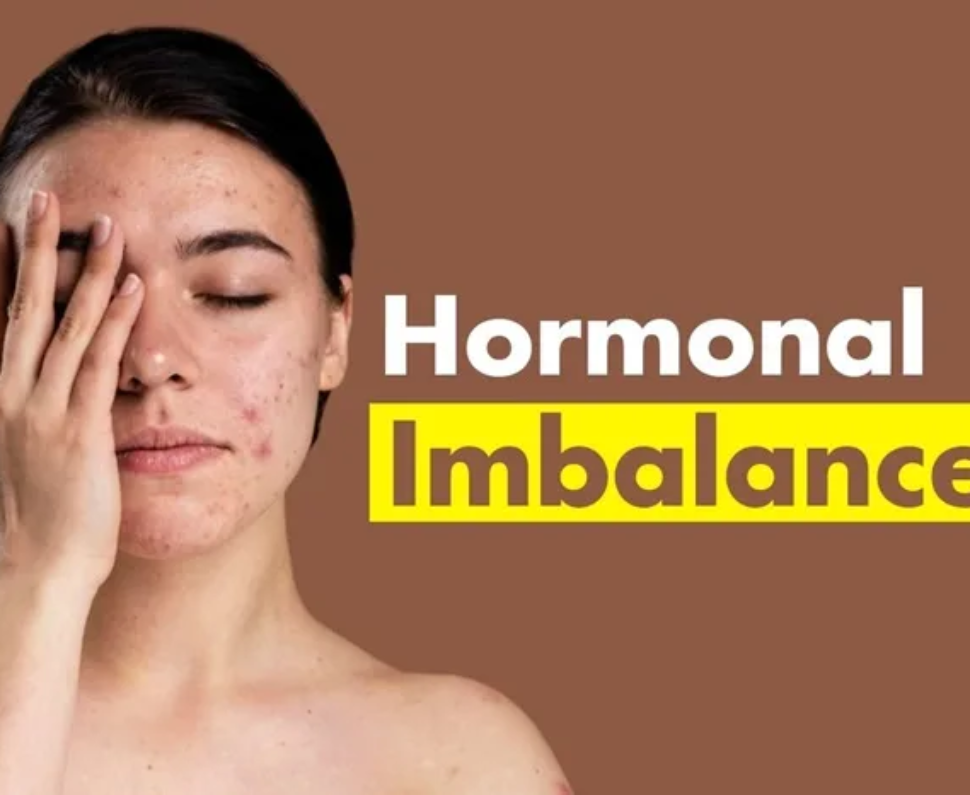 Hormonal Imbalance, PCOS & Fertility Issues in Women (2026)