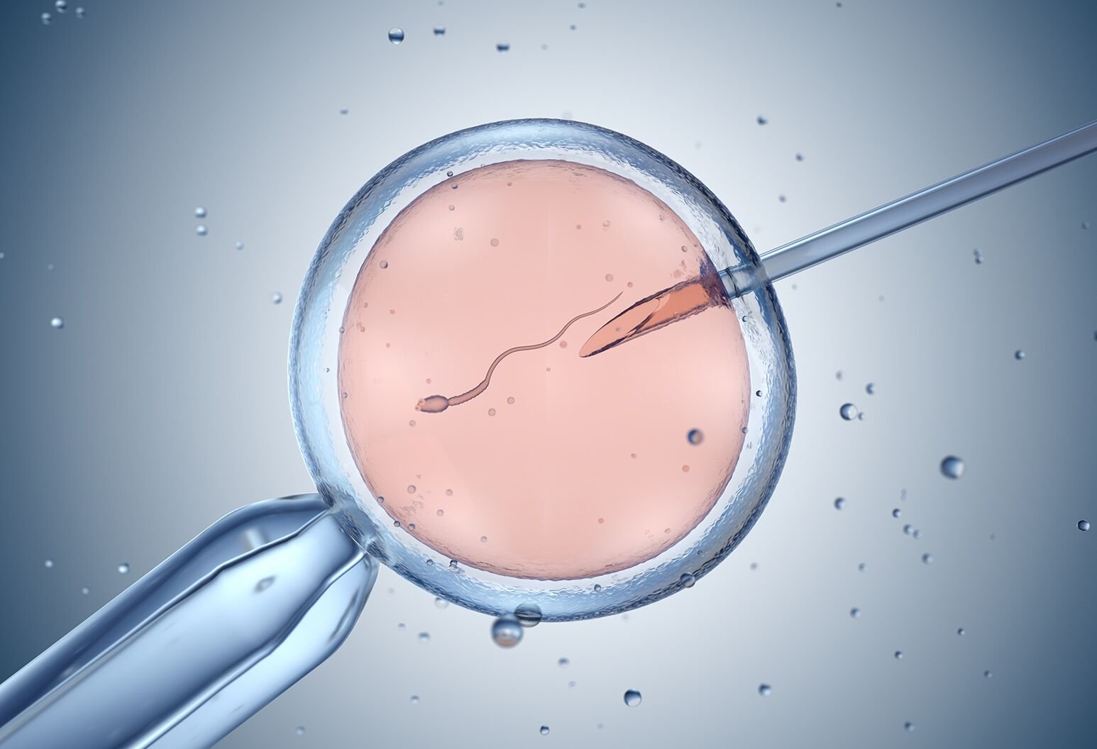 In Vitro Fertilization (IVF)
