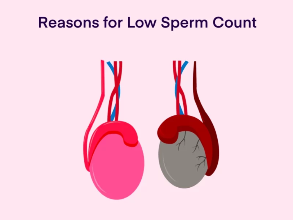 Low Sperm Count in Men: Symptoms, Causes & When to Worry