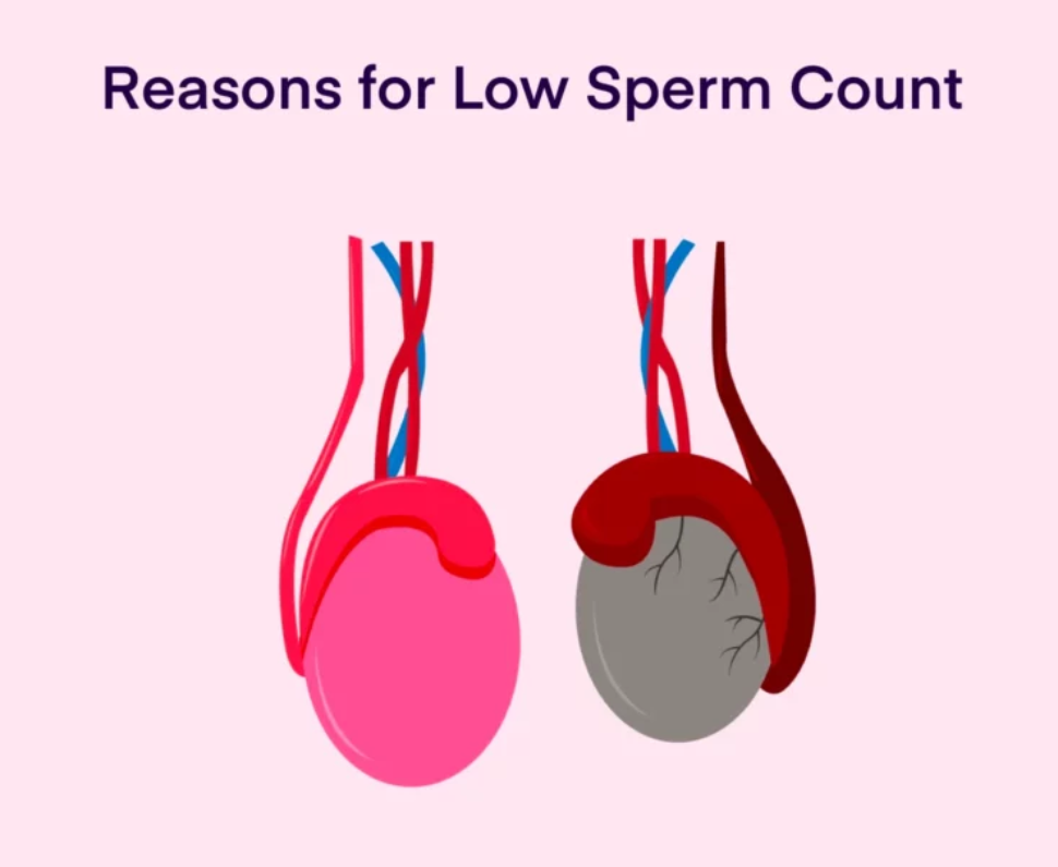 Low Sperm Count in Men: Symptoms, Causes & When to Worry
