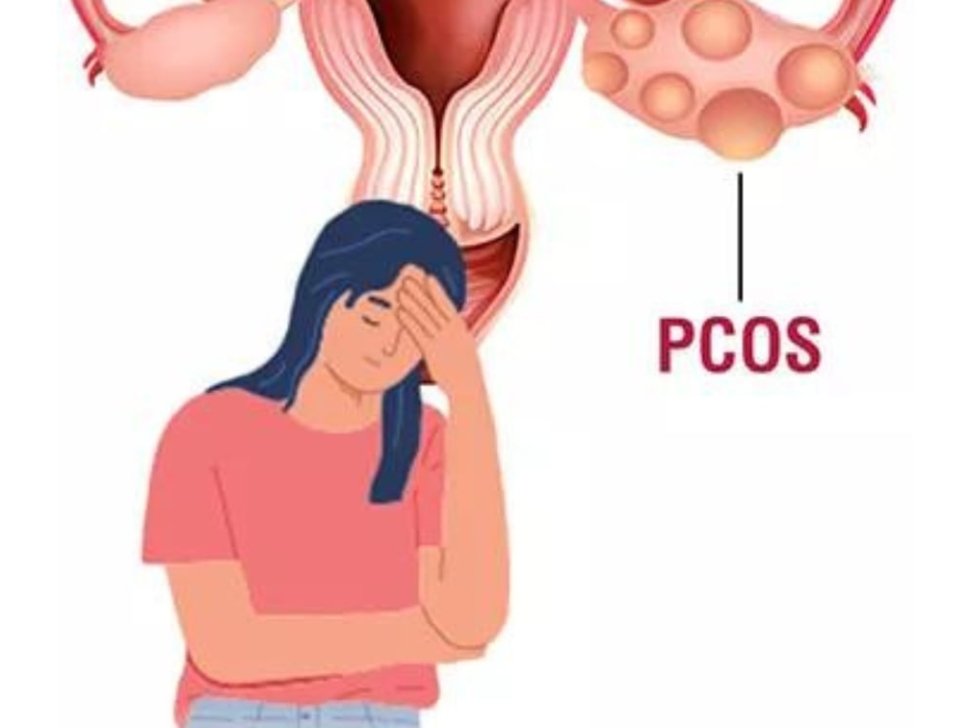 PCOS Treatment in Panchkula | PCOS Symptoms, Fertility & Pregnancy Guide