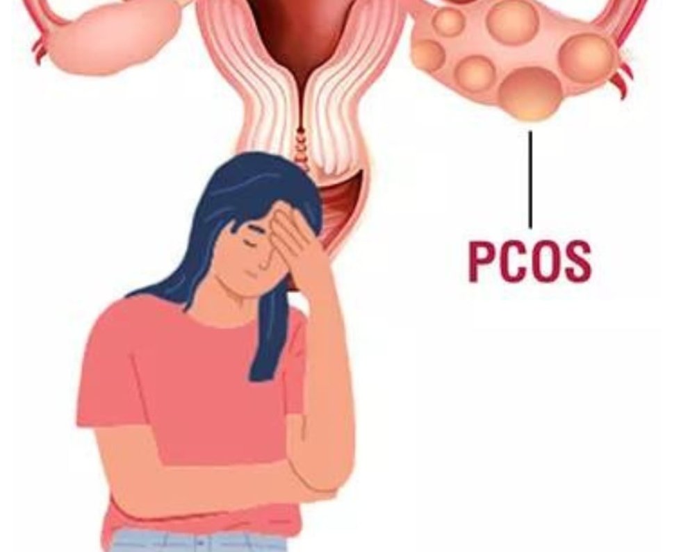PCOS Treatment in Panchkula | PCOS Symptoms, Fertility & Pregnancy Guide