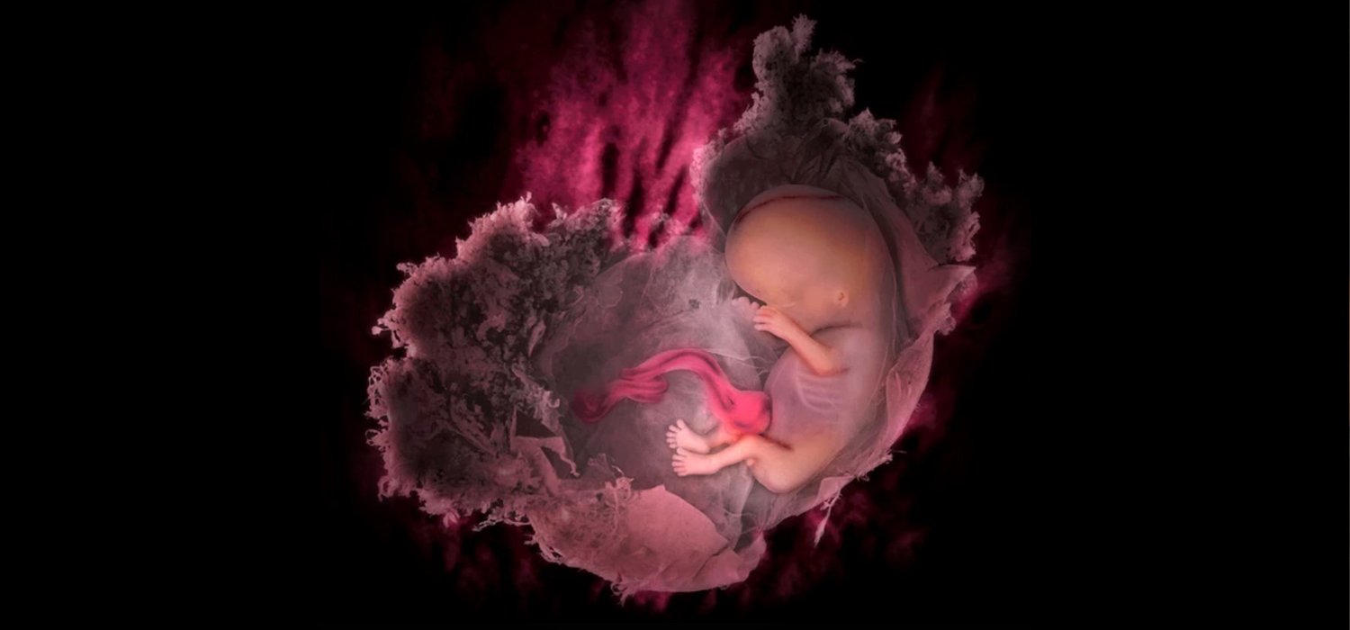 Recurrent Pregnancy Loss (RPL)