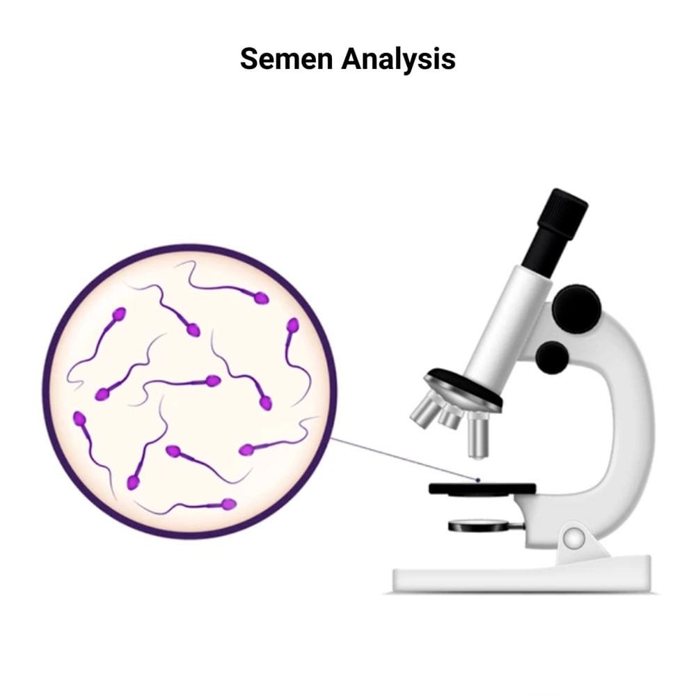 Semen Analysis