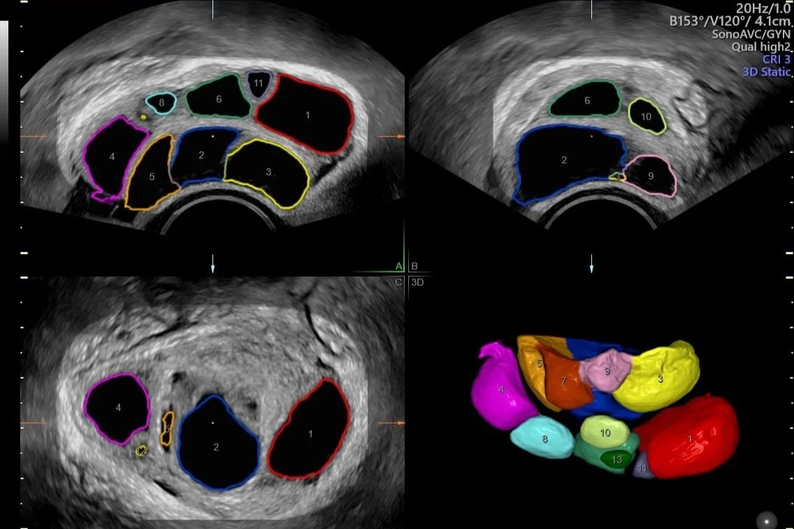 Ultrasonography — Follicle tracking & pregnancy scans