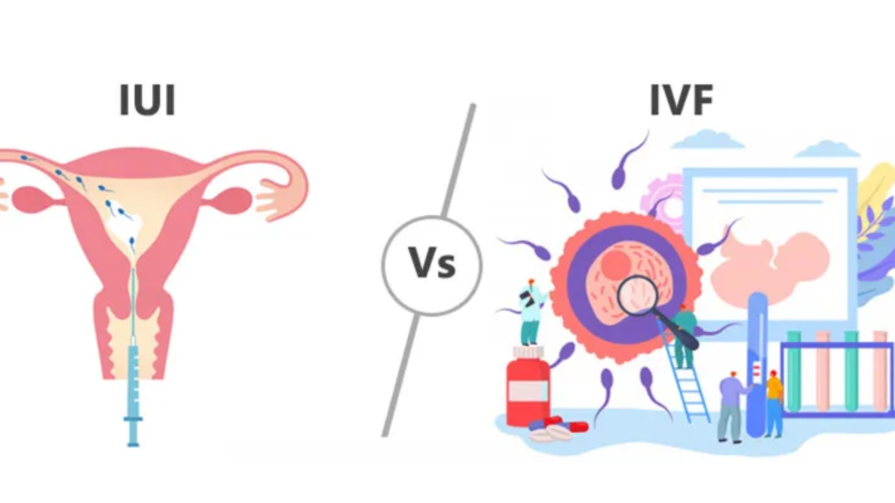 IVF vs IUI: Which Fertility Treatment is Better? | Dr. Nitasha Gupta