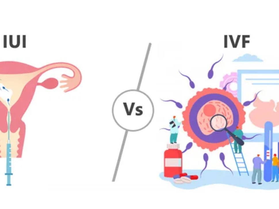IVF vs IUI: Which Fertility Treatment is Better? | Dr. Nitasha Gupta