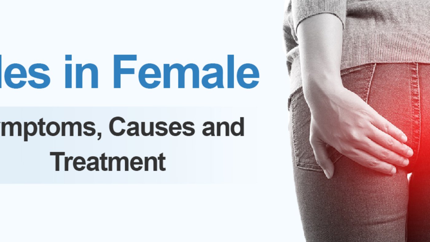 What Causes Hemorrhoids (Piles)? Symptoms, Treatment