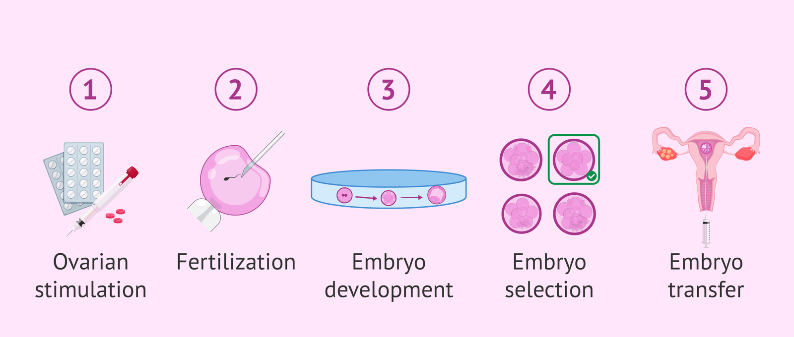 What Is IVF (In Vitro Fertilization)?