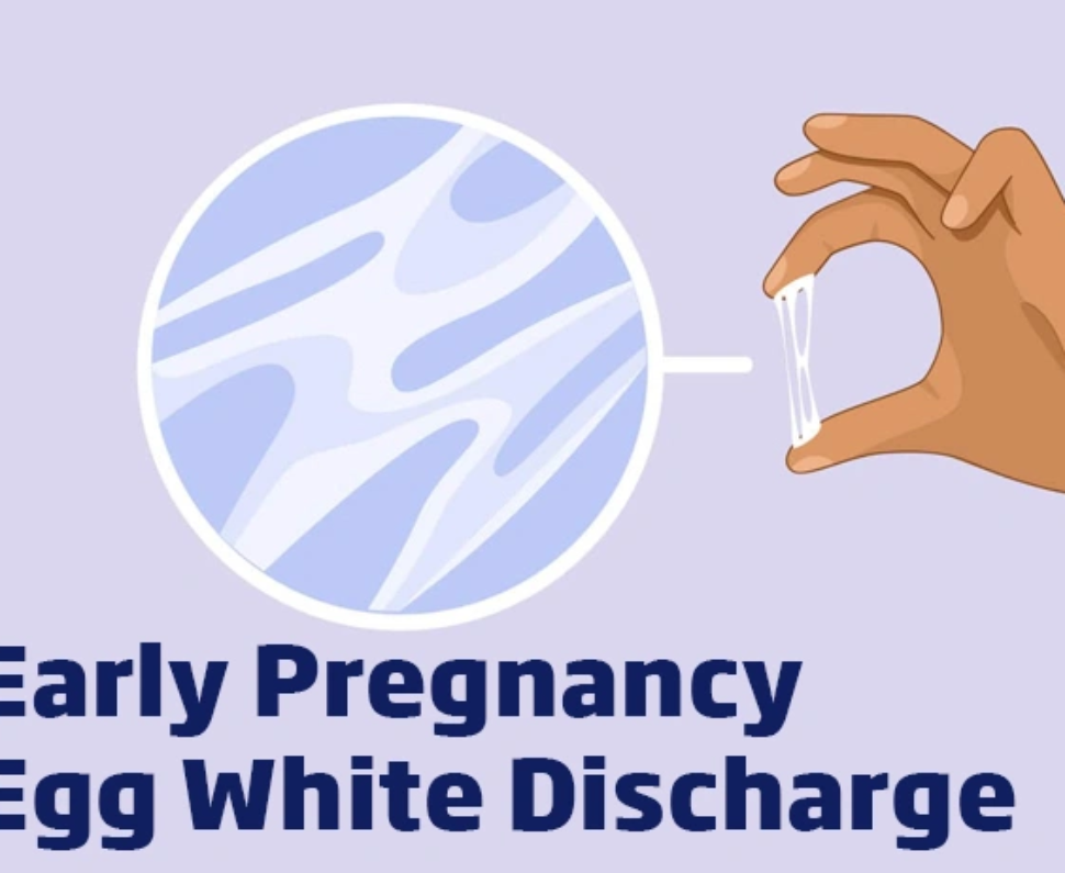 White Discharge Before Period: Normal or Pregnancy Sign?