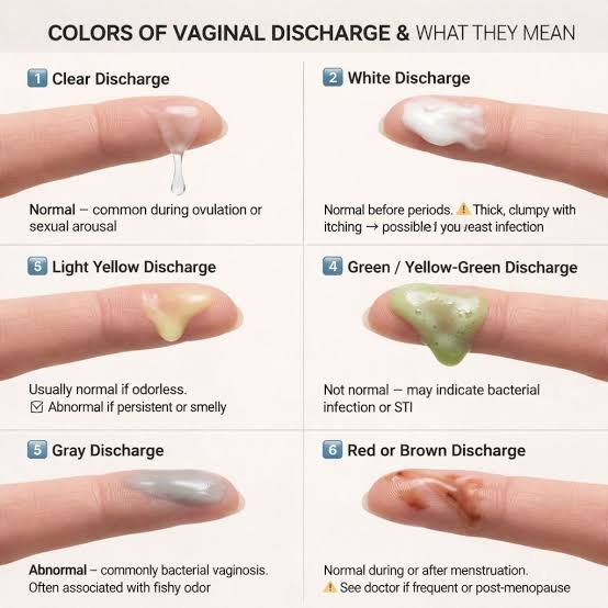 Types of White Discharge and What They May Mean