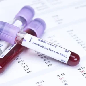 What Tests May Be Needed Before IVF?